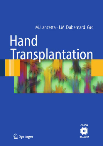 Hand Transplantation