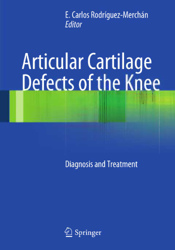 Articular Cartilage Defects of the Knee: Diagnosis and Treatment