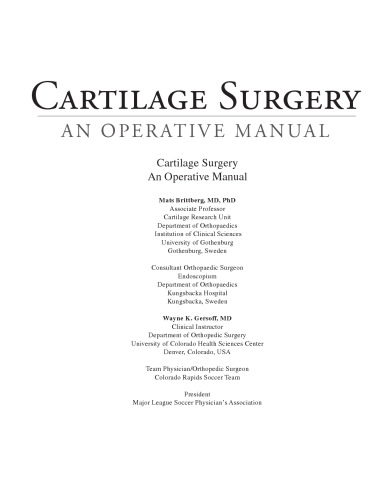 Cartilage Surgery