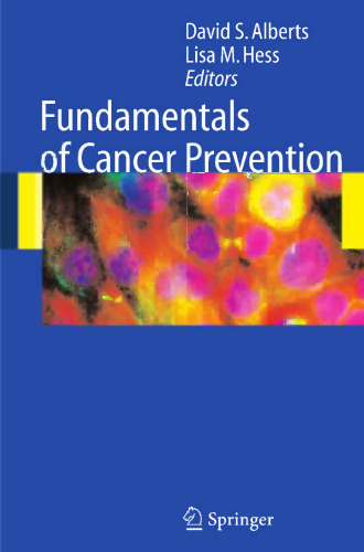 Fundamentals of Cancer Prevention