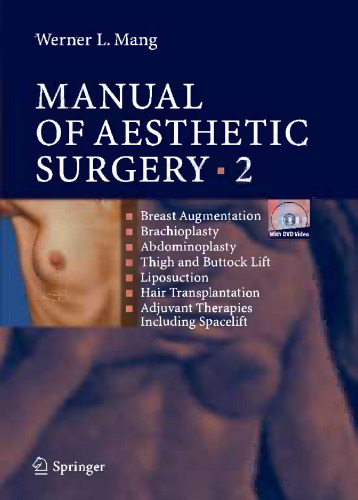 Manual of Aesthetic Surgery 2: à Breast Augmentation à Brachioplasty à Abdominoplasty à Thigh and Buttock Lift à Liposuction à Hair Transplantation à Adjuvant Therapies Including Spacelift