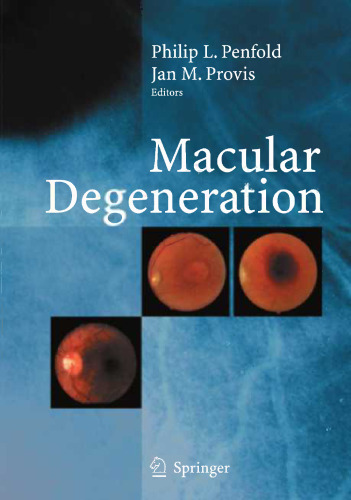 Macular Degeneration