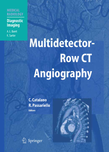 Multidetector-Row CT Angiography