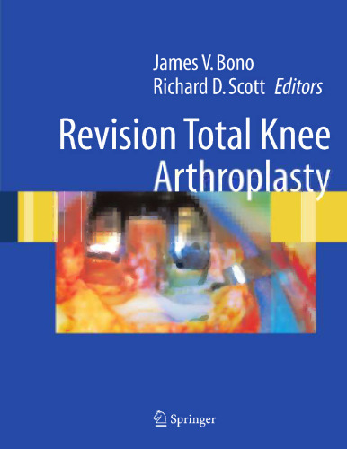 Revision Total Knee Arthroplasty