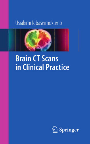 Brain CT Scans in Clinical Practice