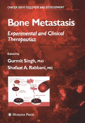 Bone Metastasis: Experimental and Clinical Therapeutics