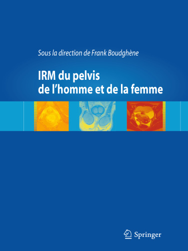 IRM du pelvis de l’homme et de la femme