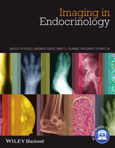 Imaging in Endocrinology