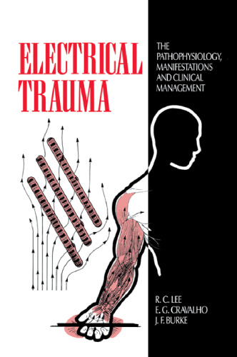 Electrical Trauma: The Pathophysiology, Manifestations and Clinical Management