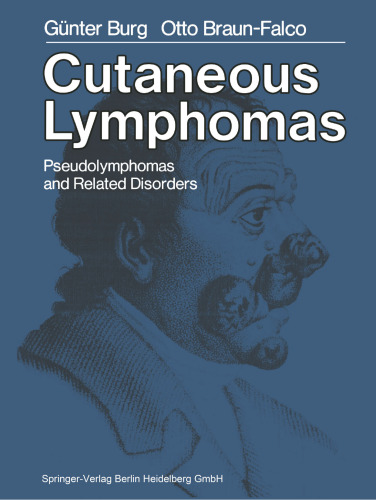 Cutaneous Lymphomas, Pseudolymphomas, and Related Disorders