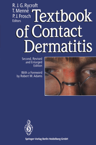 Textbook of Contact Dermatitis