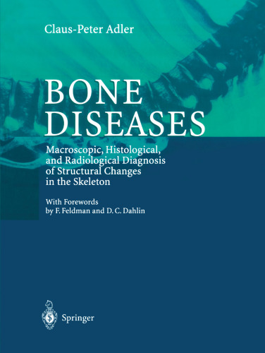 Bone Diseases: Macroscopic, Histological, and Radiological Diagnosis of Structural Changes in the Skeleton