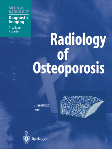 Radiology of Osteoporosis