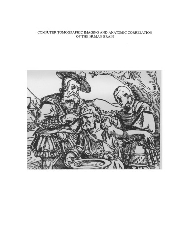 Computer Tomographic Imaging and Anatomic Correlation of the Human Brain: A comparative atlas of thin CT-scan sections and correlated neuro-anatomic preparations