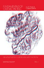 Fundamentals of Cardiac Pacing