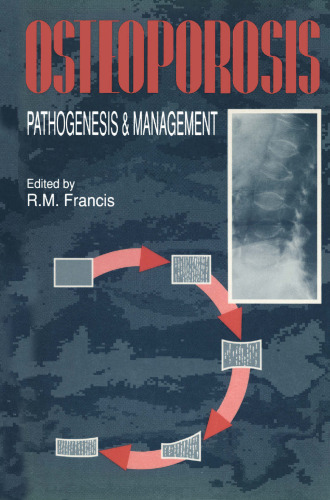 Osteoporosis: Pathogenesis and Management