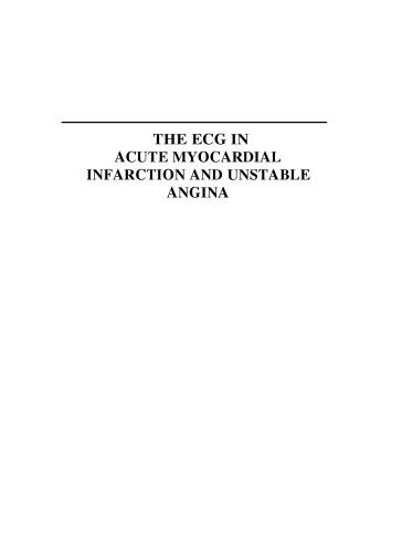 The ECG in Acute Myocardial Infarction and Unstable Angina: Diagnosis and Risk Stratification