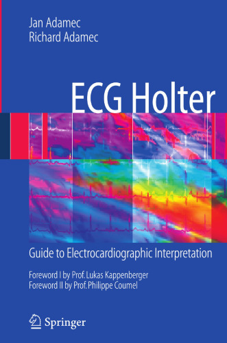 ECG Holter: Guide to Electrocardiographic Interpretation