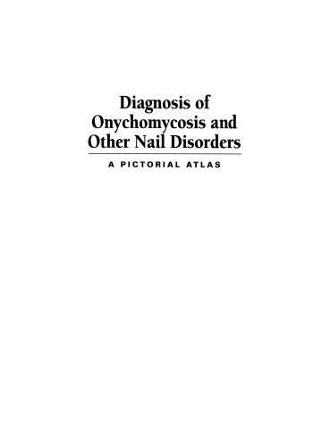 Diagnosis of Onychomycosis and Other Nail Disorders: A Pictorial Atlas