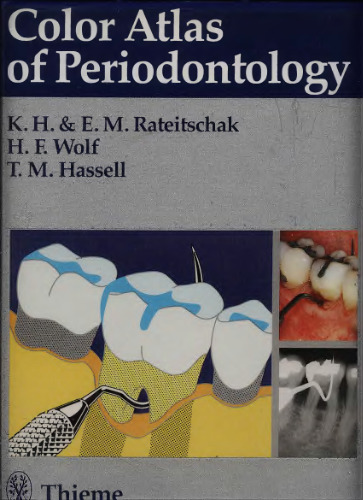 Color atlas of periodontology