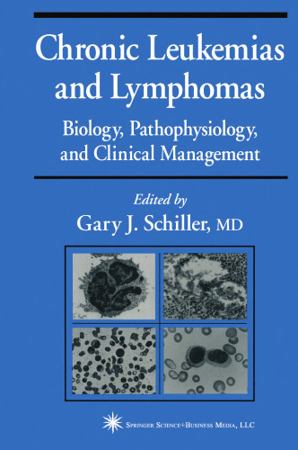 Chronic Leukemias and Lymphomas: Biology, Pathophysiology, and Clinical Management