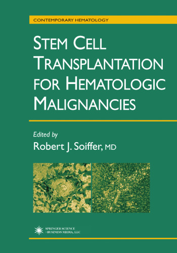 Stem Cell Transplantation for Hematologic Malignancies