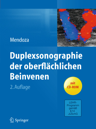 Duplexsonographie der oberflächlichen Beinvenen