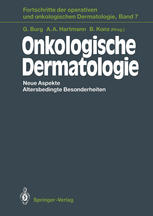 Onkologische Dermatologie: Neue Aspekte Altersbedingte Besonderheiten