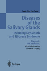 Diseases of the Salivary Glands Including Dry Mouth and Sjögren’s Syndrome: Diagnosis and Treatment