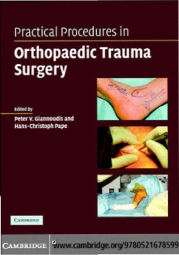 Practical Procedures in Orthopaedic Trauma Surgery