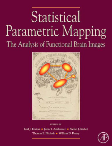 Statistical parametric mapping: the analysis of funtional brain images