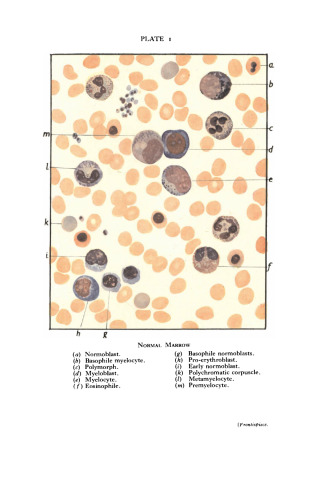 Sternal Puncture. A Method of Clinical and Cytological Investigation