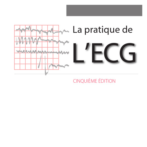 La Pratique De L'ECG