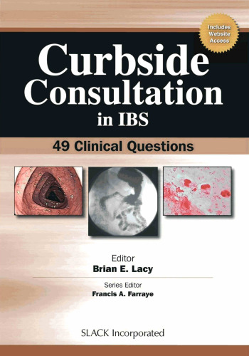 Curbside Consultation in IBS: 49 Clinical Questions