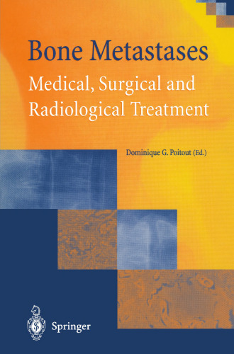 Bone Metastases: Medical, Surgical and Radiological Treatment