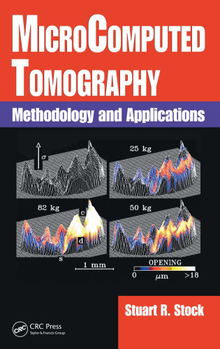 Microcomputed tomography: methodology and applications