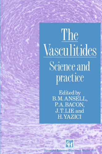 The Vasculitides: Science and practice