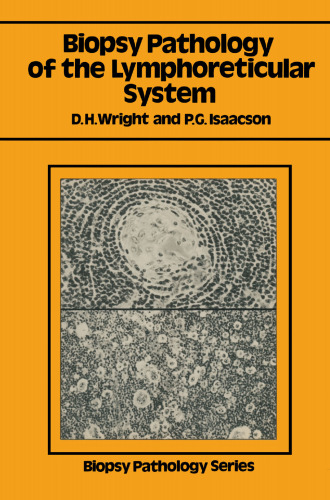 Biopsy Pathology of the Lymphoreticular System