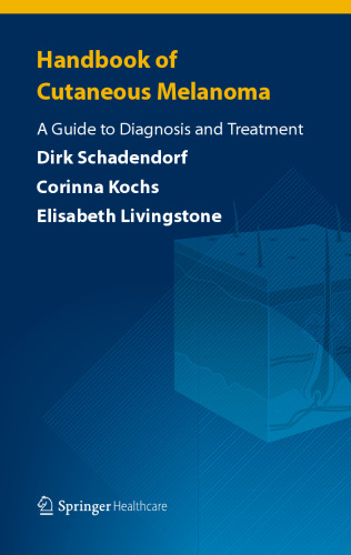 Handbook of Cutaneous Melanoma: A Guide to Diagnosis and Treatment