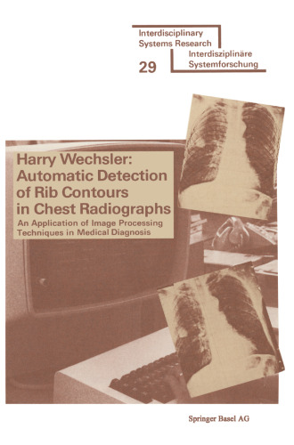 Automatic Detection of Rib Contours in Chest Radiographs: An Application of Image Processing Techniques in Medical Diagnosis