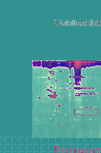 Proteome Research: Two-Dimensional Gel Electrophoresis and Identification Methods