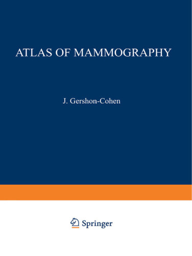 Atlas of Mammography