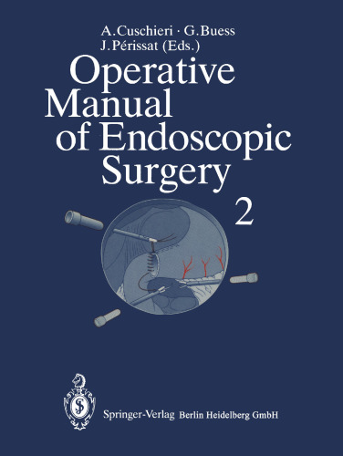 Operative Manual of Endoscopic Surgery 2