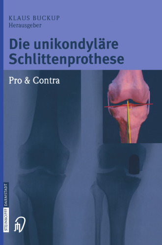 Die unikondyläre Schlittenprothese Pro & Contra