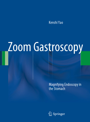 Zoom Gastroscopy: Magnifying Endoscopy in the Stomach