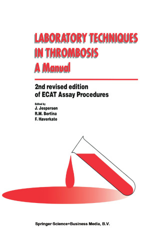 Laboratory Techniques in Thrombosis — a Manual