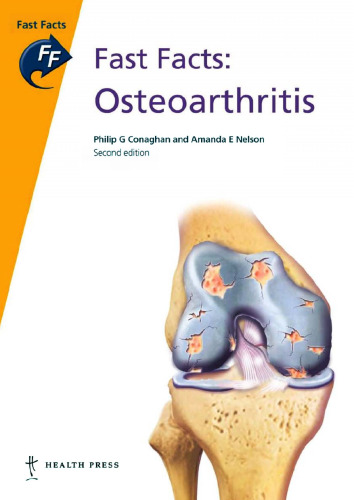 Fast Facts: Osteoarthritis