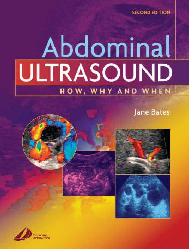 Abdominal Ultrasound How, Why and When