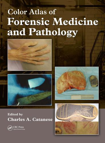 Color Atlas of Forensic Medicine and Pathology