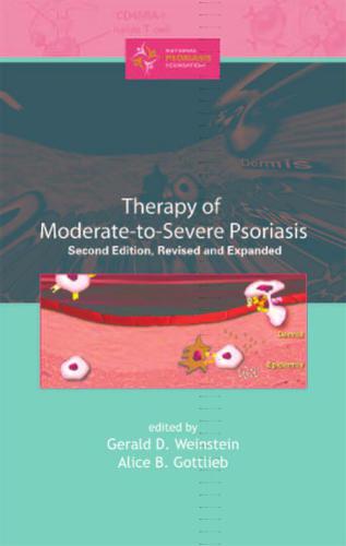 Therapy of Moderate-to-Severe-Psoriasis, Second Edition